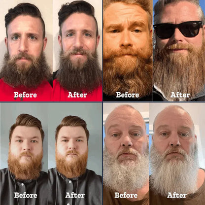 Ionic Beard Straightener 2.0